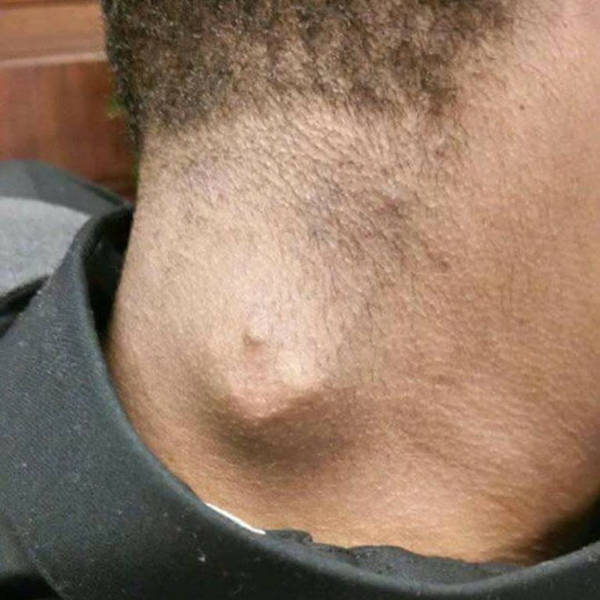 State v. Keith Davis, Jr. – Addendum 4 – In Sickness and In Health