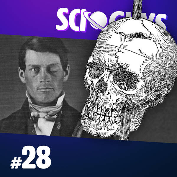 28: The Curious Case of Phineas Gage