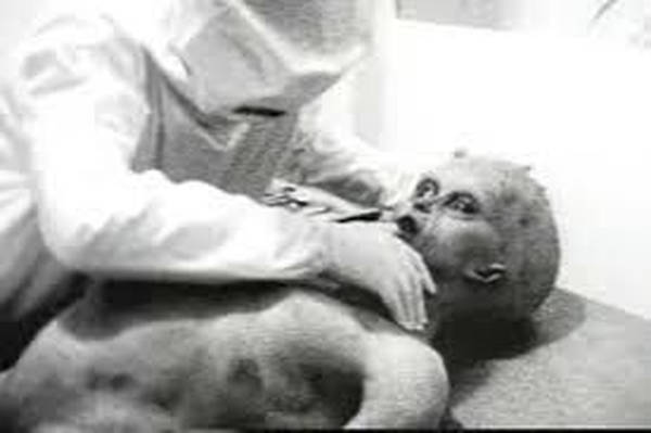 35: The Alien Autopsy Hoax Part 1