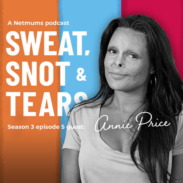 S1 Ep34: Annie Price: what being a burns survivor taught me about communicating with kids