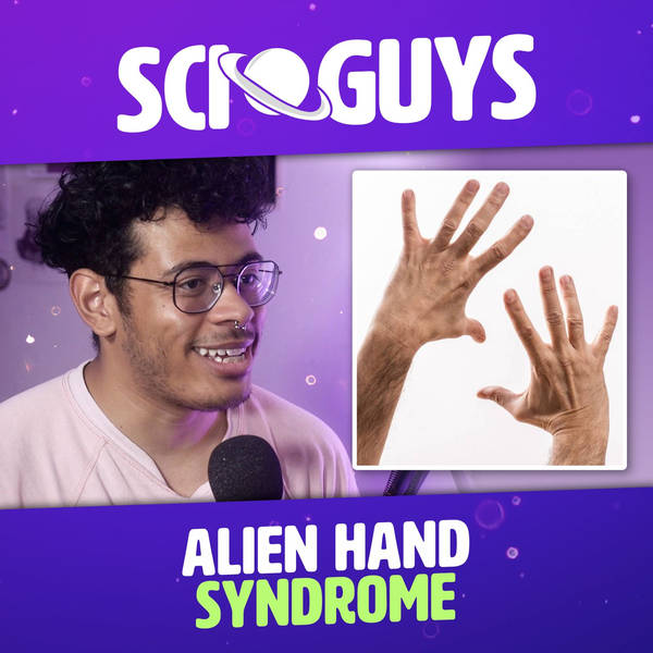 114: Alien Hand Syndrome