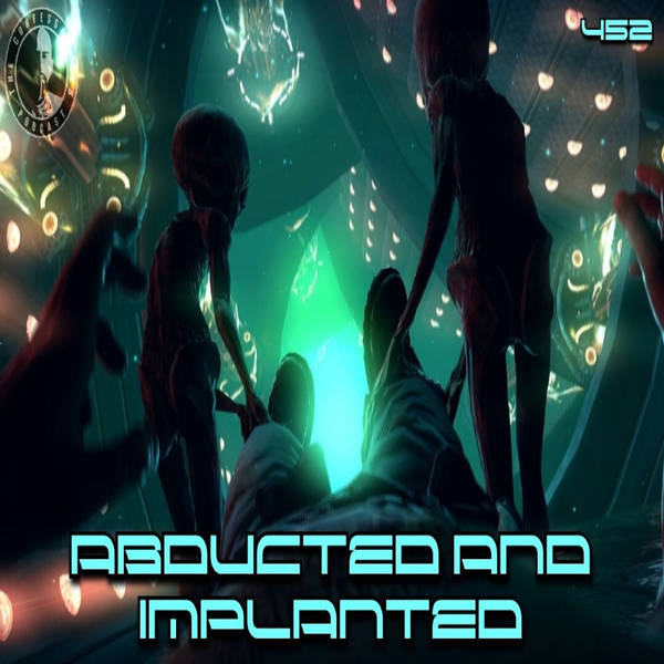 452: Abducted and Implanted