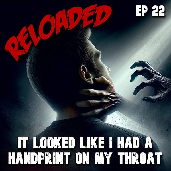 RELOADED | 22: It Looked Like I Had a Handprint On My Throat