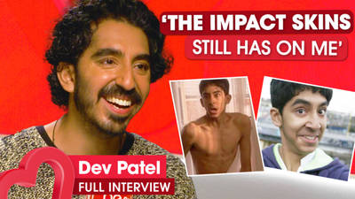 Dev Patel can never forget his days on Skins image