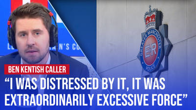 'It was extraordinarily excessive force.' image