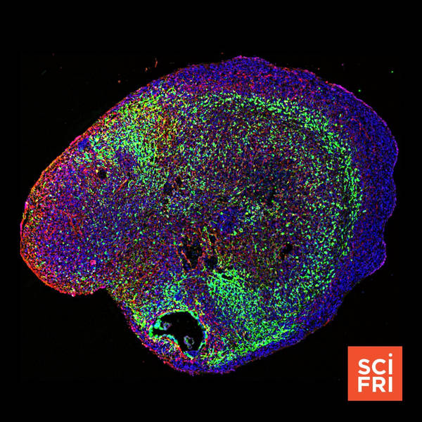 Brain ‘Organoids’: Lab-Grown Cell Clusters Model Brain Functions