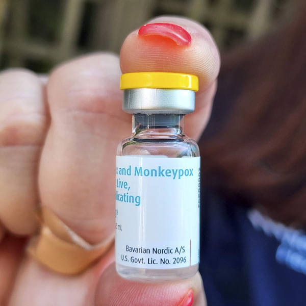 As Monkeypox Cases Climb, U.S. Officials Increase Testing and Order More Vaccine Doses