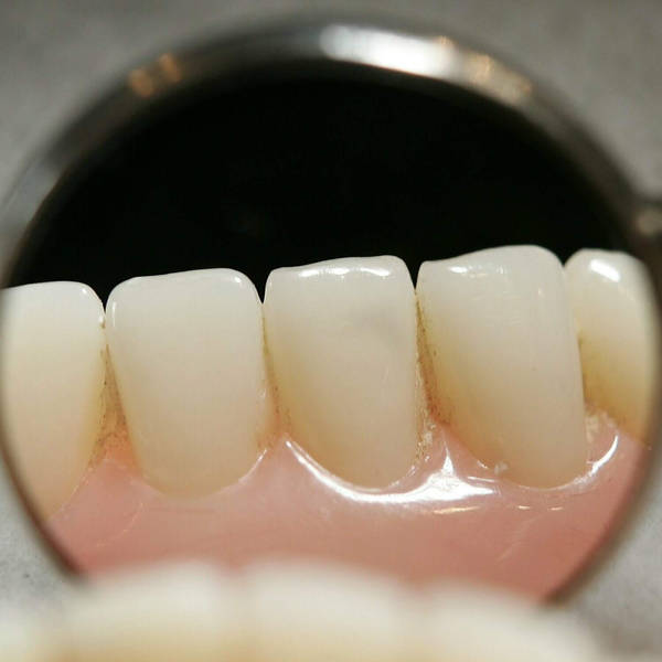 The value of good teeth