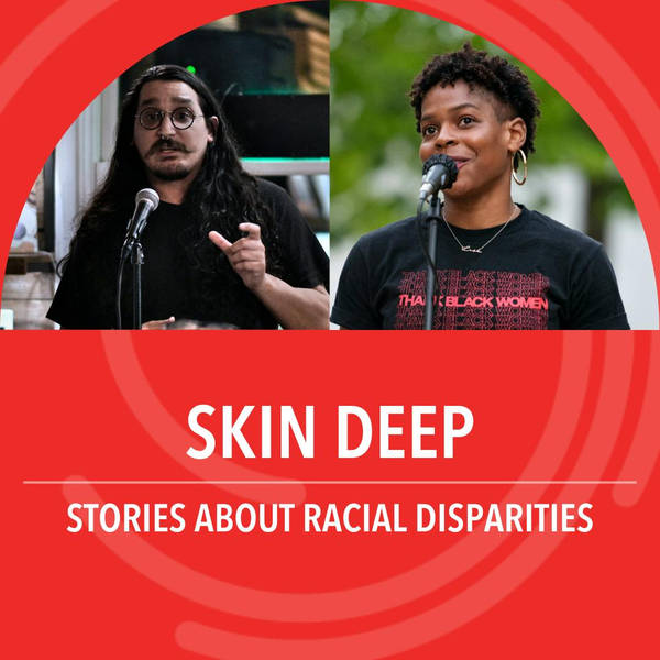 Skin Deep: Stories about racial disparities