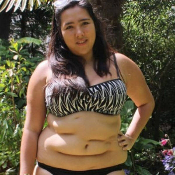 Body Confidence Coach Michelle Elman - Surgeries and scars, the diet industry and 'inter-weight' relationships